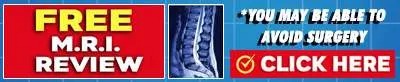 imgi_2_Free-MRI-Review-Small